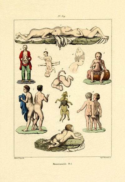 フリーク、1833-39 作： French School